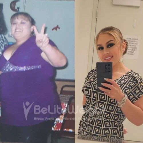 Carmen D - RNY gastric bypass 3 years update*